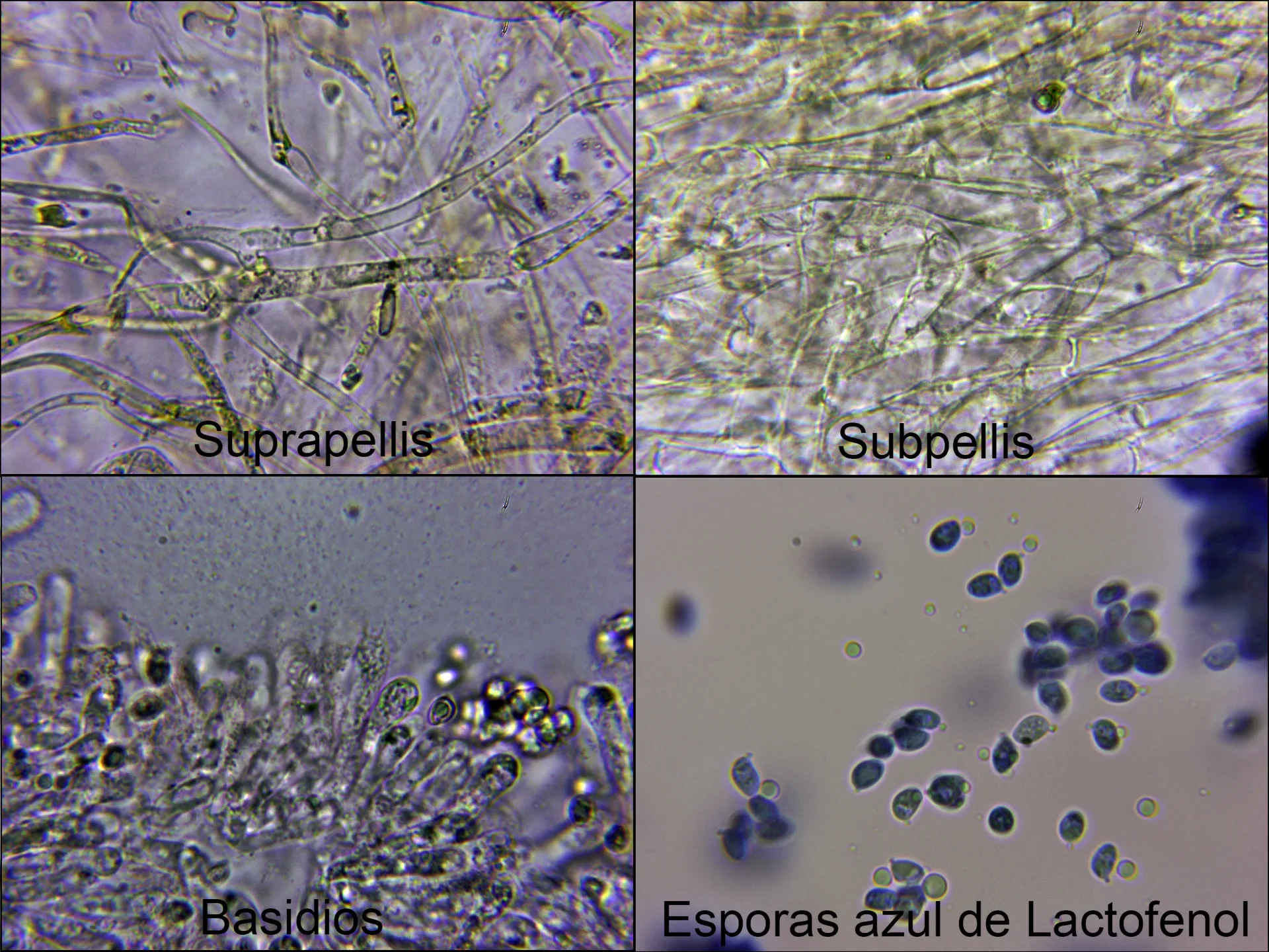 Microscopía de Leucocortinarius bulbiger - 11 -  micro